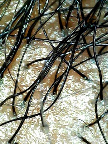 oily-scalp
